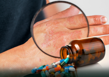 카자흐스탄 의료진, 새로운 중증 ‘포스트 코로나 증후군’ 경고