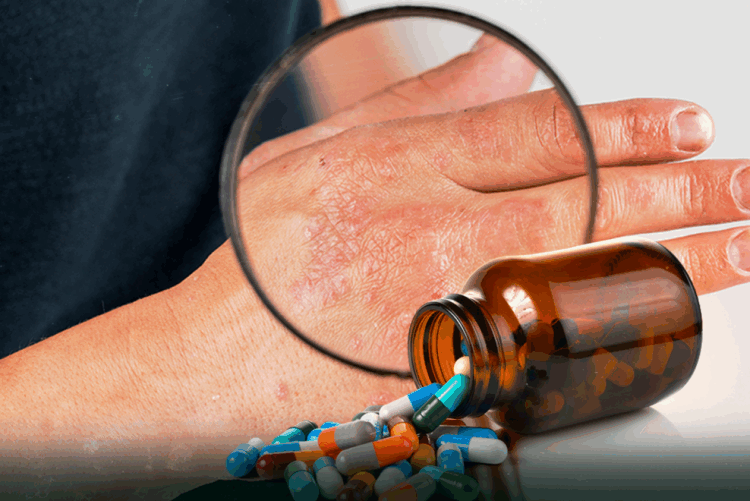 카자흐스탄 의료진, 새로운 중증 ‘포스트 코로나 증후군’ 경고